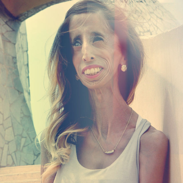 Lizzie Velasquez: O inimă curajoasă